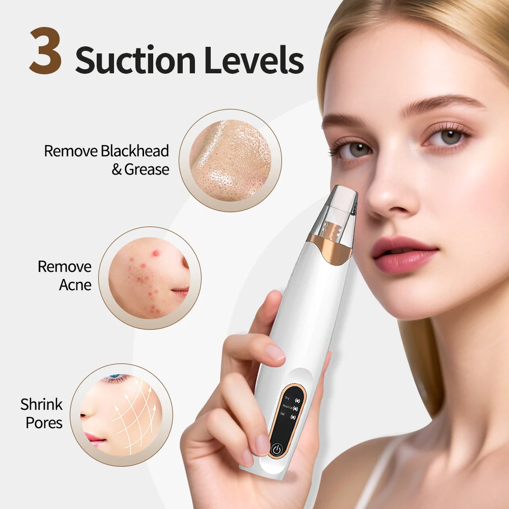 Facial Blackhead Vacuum – Electric Skin Care Pore Cleaner Tool”