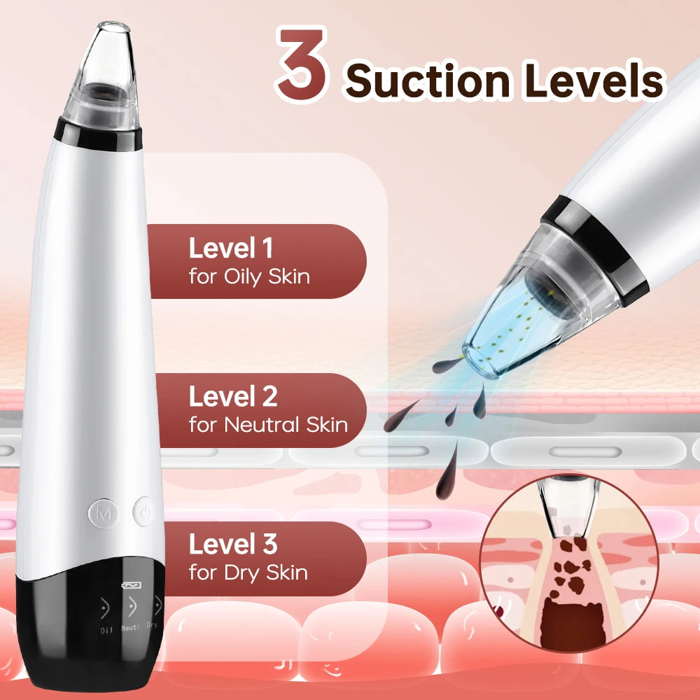Facial Blackhead Vacuum – Electric Skin Care Pore Cleaner Tool”