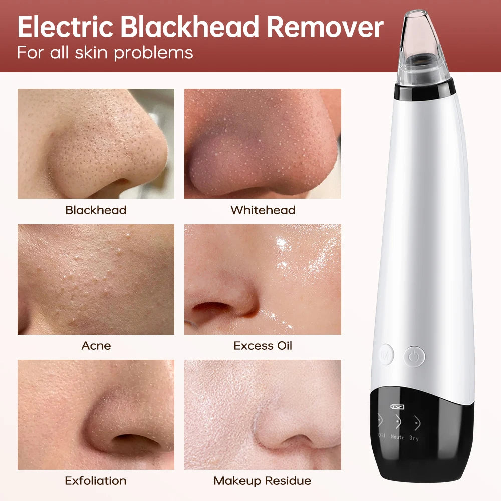 Facial Blackhead Vacuum – Electric Skin Care Pore Cleaner Tool”